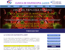 Tablet Screenshot of colposcopiagdl.com